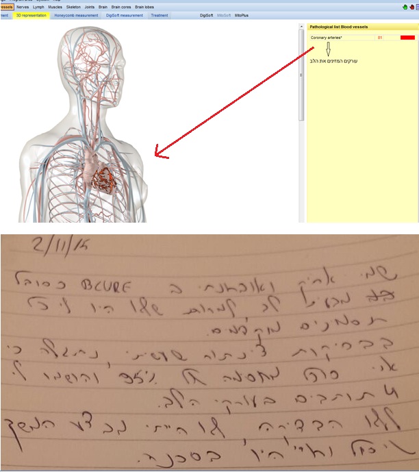 אריק הגיע לבדיקה שגרתית, הוא לא חש כאבים ולא היו לו בעיות לב שהוא ידע עליהם. בבדיקה אצלנו התגלתה חסימת עורקים ברמה גבוהה מאוד באזור הלב. 